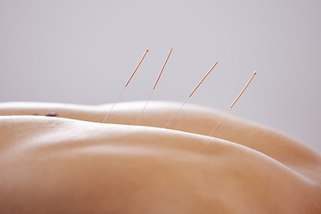 Image showing Person, back and acupuncture with wellness massage, spa treatment and luxury with body care. Human, model and physiotherapy with self care, needles and alternative pain healthcare with stress relief