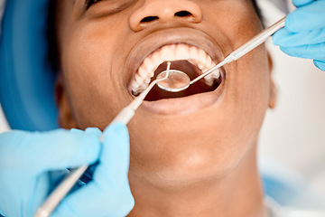 Image showing Dentist, black woman mouth and patient at a clinic with medical and healthcare for teeth cleaning. Mirror, orthodontist and African female person with wellness and dental work tool with care