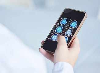 Image showing Brain x ray, clinic phone results and doctor hands with digital report about neurology work. Anatomy, xray and assessment data with a healthcare employee holding mri test information in a hospital