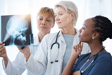 Image showing Xray, women doctors and radiology team planning for test, results charts and healthcare analysis advice. Medical group, neurology and hospital x ray scan of skull, anatomy and review for mri analysis