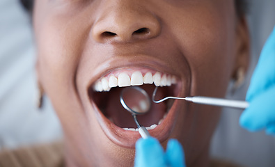 Image showing Checkup, teeth and woman with a dentist for oral hygiene, cavity check or cleaning mouth. Zoom, dental and doctor with mirror to look at the tooth of a girl for healthcare, treatment and examination