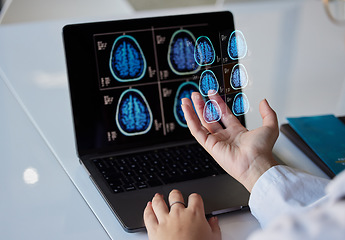 Image showing Brain x ray graphic, clinic results and doctor hands with digital report about neurology work. Anatomy, xray and assessment data with a healthcare employee holding mri test information in a hospital