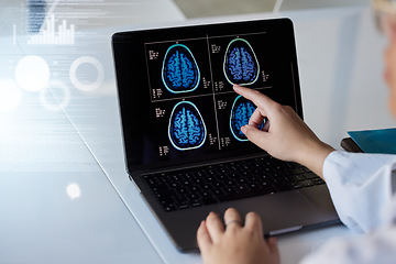 Image showing Brain x ray, computer results and doctor hands with digital report graphic about neurology. Anatomy, xray and assessment data with a healthcare employee with mri test information in a hospital