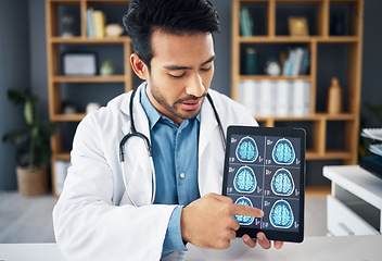 Image showing Brain x ray, video call and doctor with a tablet for advice, healthcare results and showing scan. Education, teaching and an Asian medical worker pointing to radiology research on tech for a webinar