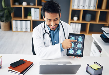 Image showing Video call, laptop and doctor with brain scan on tablet for telehealth, online consulting and patient results. Healthcare, communication and man with digital tech for medical care, service and x ray