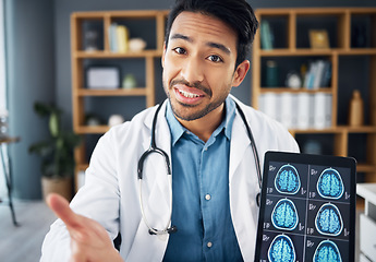 Image showing Portrait, Asian man and doctor with tablet, mri results and explain diagnosis in office, conversation and healthcare. Face, medical professional and employee with device, brain scan and neurology