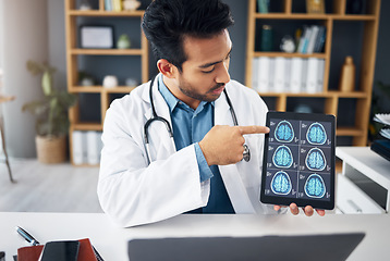 Image showing Neuroscience, man and doctor with scans, explain diagnosis or healthcare in workplace. Male consultant, employee or medical professional with tablet, talking or analysis for solution or brain results