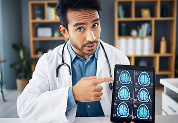 Image showing Brain x ray, video call and portrait of doctor with a tablet for healthcare results and showing scan. Analysis, teaching and Asian medical worker pointing to radiology research on tech for a webinar