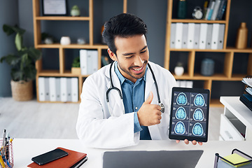 Image showing Video call, x ray and doctor with brain scan on tablet for telehealth, online consulting and patient results. Healthcare tech, communication and man on computer for medical care, neurology or service