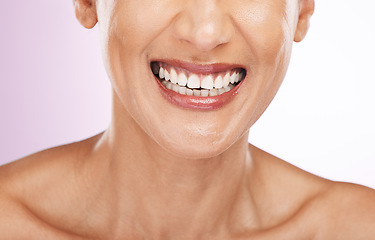 Image showing Face, smile and dental teeth of woman with veneers, smiling or tooth whitening in studio isolated on a purple background. Oral health, skincare makeup and lip cosmetics of happy female with beauty.