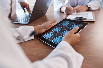 Image showing Doctor, tablet screen and hands of person with brain scan MRI, cancer tumor results and consulting on digital xray data. Closeup teamwork, radiology and neurosurgeon collaboration on anatomy exam