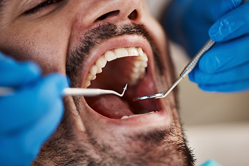 Image showing Mouth, man and hands of dentist with tools for dental, healthcare or check in clinic. Oral wellness, orthodontics and patient with doctor, mirror and excavator for teeth cleaning and medical hygiene