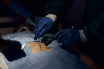 Image showing Surgeon hands, person and surgery operation, emergency service or help patient in dark room. Healthcare tools, operating theatre and closeup doctors doing medical procedure on client anatomy at night