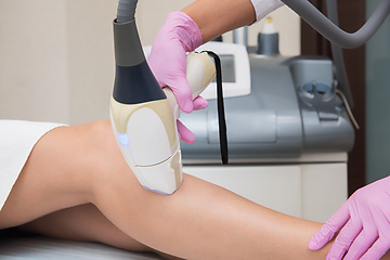 Image showing Hair removal procedure