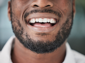 Image showing Dental, smile and mouth of man closeup for cosmetic, care and oral hygiene treatment results. Happy, teeth whitening and male person confident, breath or tooth cleaning, bleaching or satisfaction