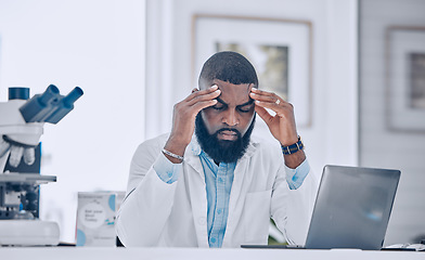 Image showing Headache, stress and tired man with burnout from science, research mistake and laptop error in laboratory. Sick, sad or frustrated african scientist with pain, migraine and fatigue for mental health