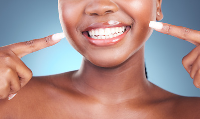 Image showing Happy woman, teeth and pointing in dental cleaning, hygiene or treatment against a blue studio background. Closeup of female person mouth in tooth whitening, oral and gum care with big smile