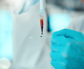 Image showing Hands of scientist with blood in pipette, glass and laboratory research, dna results and medical engineering. Biotechnology, pharmaceutical study and lab technician with solution for pathology test.