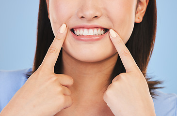 Image showing Woman, clean smile and point in studio closeup for dental healthcare, teeth whitening or happy by blue background. Girl, mouth and excited for beauty, transformation and tooth wellness for hygiene