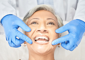 Image showing Senior woman, mouth and dentist hands with dental procedure, medical and healthcare with closeup. Oral health, orthodontics and patient with doctor, teeth whitening and veneers with assessment