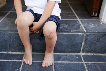 Image showing Mom needs to kiss it better.... A young boy sitting on a step with a cut on his knee - cropped.