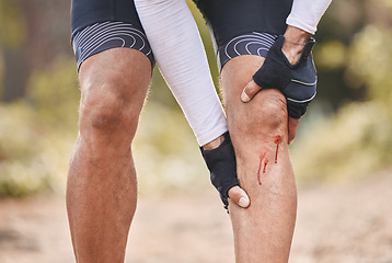 Image showing Fitness, knee pain and man with blood, injury or sports mistake in park for cycling, training or exercise accident. Bleeding, wound and cyclist with biking fail, joint or leg emergency or broken bone