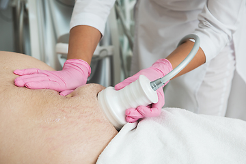 Image showing Belly cavitation at modern beauty clinic