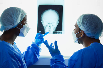 Image showing Head xray, doctors and medical discussion for planning test results, charts and advice for expert analysis. Radiology, neurology and surgeon team check skull x ray, anatomy and review mri for surgery