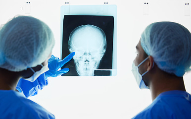 Image showing Head xray, doctors and healthcare team planning test results, charts and advice for medical analysis. Radiology, neurology and surgeons check skull x ray, anatomy and review mri for hospital surgery