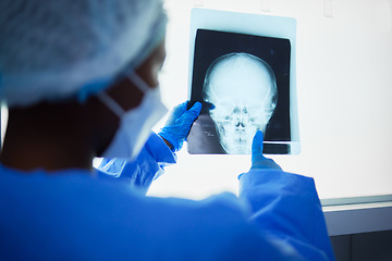 Image showing Brain xray, medical doctor and surgery charts, test results and healthcare analysis of the head. Radiology, neurology and surgeon check skull x ray, anatomy and review mri for hospital operation