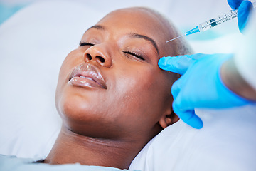 Image showing Plastic surgery, injection and black woman on a hospital bed with dermatology with mockup space. Surgeon, facial change and medical filler for skincare, syringe and wellness in a clinic with doctor