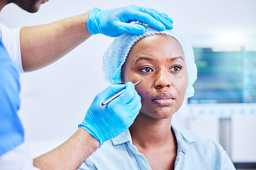 Image showing Plastic surgery, pen and black woman in a hospital with dermatology with beauty aesthetics therapist. Surgeon, facial change and filler for skincare, cosmetics and wellness in a clinic with doctor