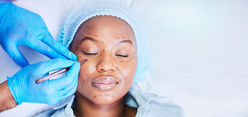 Image showing Plastic surgery, pen and black woman sleep on a hospital bed with dermatology with mockup space. Surgeon, facial change and medical filler for skincare, cosmetics and wellness in a clinic with doctor