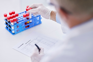 Image showing Science, blood sample and hands with test tube and notes for research, medical study and DNA in lab. Healthcare, pharmaceutical and scientist with vial writing for data analysis, report or checklist