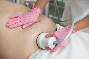 Image showing Belly cavitation at modern beauty clinic