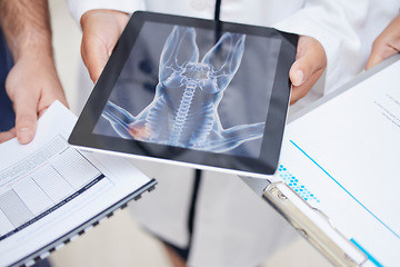 Image showing Doctor, hands and tablet with x ray in anatomy, surgery or results in MRI, CT or body scan at hospital. Closeup of medical professional team with technology or documents in patient analysis at clinic