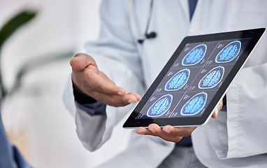 Image showing Neurology, healthcare and doctor with tablet in hands for brain research, test results or cancer innovation in hospital or clinic consultation. Medical worker on digital technology for MRI assessment