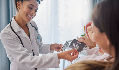 Image showing Doctor, pregnant woman and ultrasound photo with happiness, excited and family planning in clinic. Black woman medic, sonogram picture and healthcare for mother patient in hospital for pregnancy care