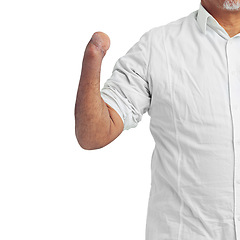 Image showing Disability, injury and arm of an injured amputee isolated on a white background in studio. Disabled, defect and body limb of a disabled man or person showing a forearm stump on a studio background