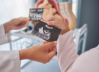 Image showing Doctor, hands and woman with ultrasound photo for fetus growth, development or family planning in clinic. Black woman medic, sonogram picture or healthcare for mother patient at hospital in pregnancy