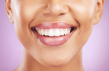 Image showing Happy woman, face or dental care on purple studio background or teeth whitening, invisible braces treatment or grooming. Zoom on beauty model smile or cosmetic mouth hygiene and healthcare cleaning