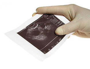 Image showing Hands with sonography