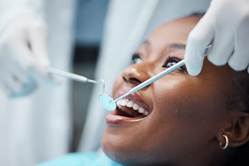 Image showing Black woman, mouth and face with dentist, tools in hands and dental, teeth check for healthcare with tooth decay. Tooth surgery, orthodontics and smile, teeth whitening, closeup and Invisalign