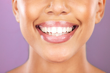 Image showing Happy woman, face or dental care on purple studio background or teeth whitening, invisible braces treatment or grooming. Zoom on beauty model smile or cosmetic mouth hygiene and healthcare cleaning