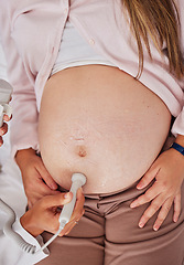 Image showing Stomach, doctor hands and ultrasound for pregnancy in hospital for health, wellness and family planning for future. Medic hand, pregnant woman and consulting with medical tech on abdomen for sonogram