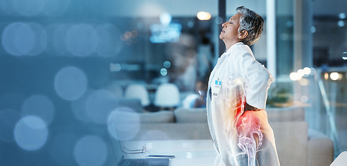 Image showing Elderly woman, doctor with back pain, spine injury with anatomy red overlay, burnout and fatigue with emergency. Health, hospital and bokeh with muscle inflammation and medical mockup with rheumatism