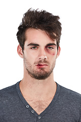 Image showing Portrait, injury and man with black eye in studio for bruise, blood and conflict in white background. Face, wound and male after domestic abuse attack, crisis and danger while standing isolated