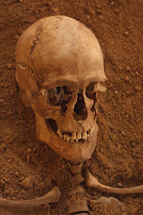 Image showing skull
