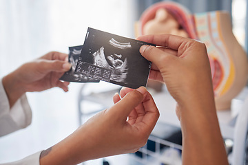 Image showing Sonogram, showing and hands with an ultrasound of a baby from the doctor to mother at a clinic. Consultation, pregnancy and pregnant woman with a picture of a child from a gynecologist at hospital