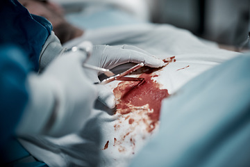 Image showing Surgery, blood and doctor hands with medical surgeon scissors for hospital and clinic emergency. Health service, doctors and wellness care of a healthcare worker working on a patient with tools